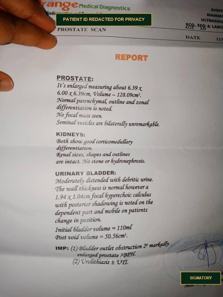 Initial Diagnostic Ultrasound Report showing 128.09 cm3 prostate volume